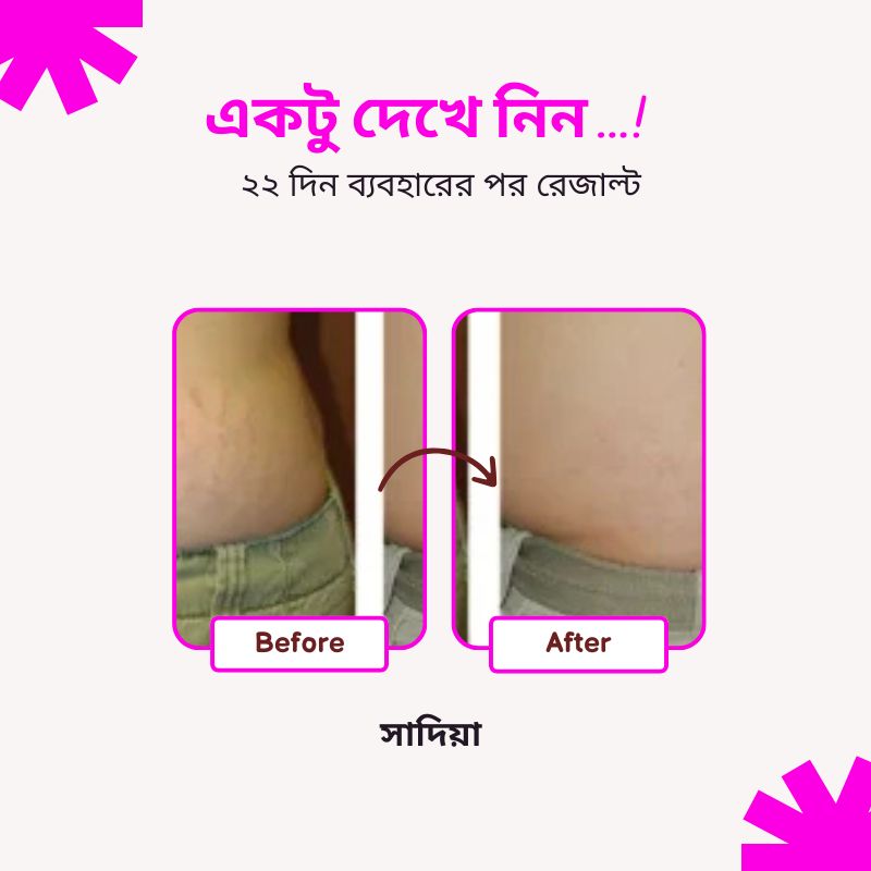 Fumira Skincare Anti-Stretch Marks Cream