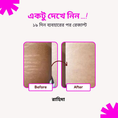 Fumira Skincare Anti-Stretch Marks Cream