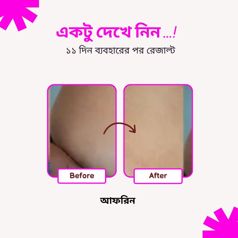 Fumira Skincare Anti-Stretch Marks Cream