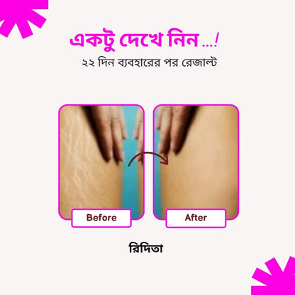 Fumira Skincare Anti-Stretch Marks Cream